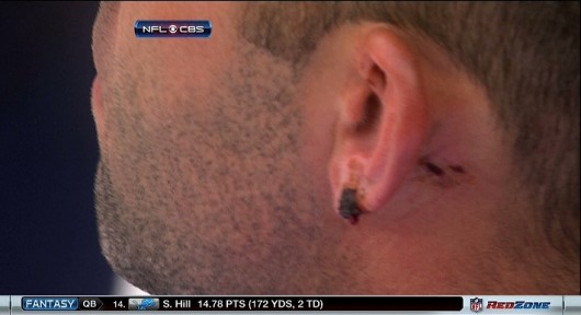 matt-schaub-ear-530x288.jpg