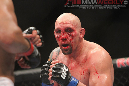 dos-Santos-vs-Carwin_0127_large.jpg