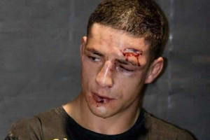 diego-sanchez-cut-up_large.jpg