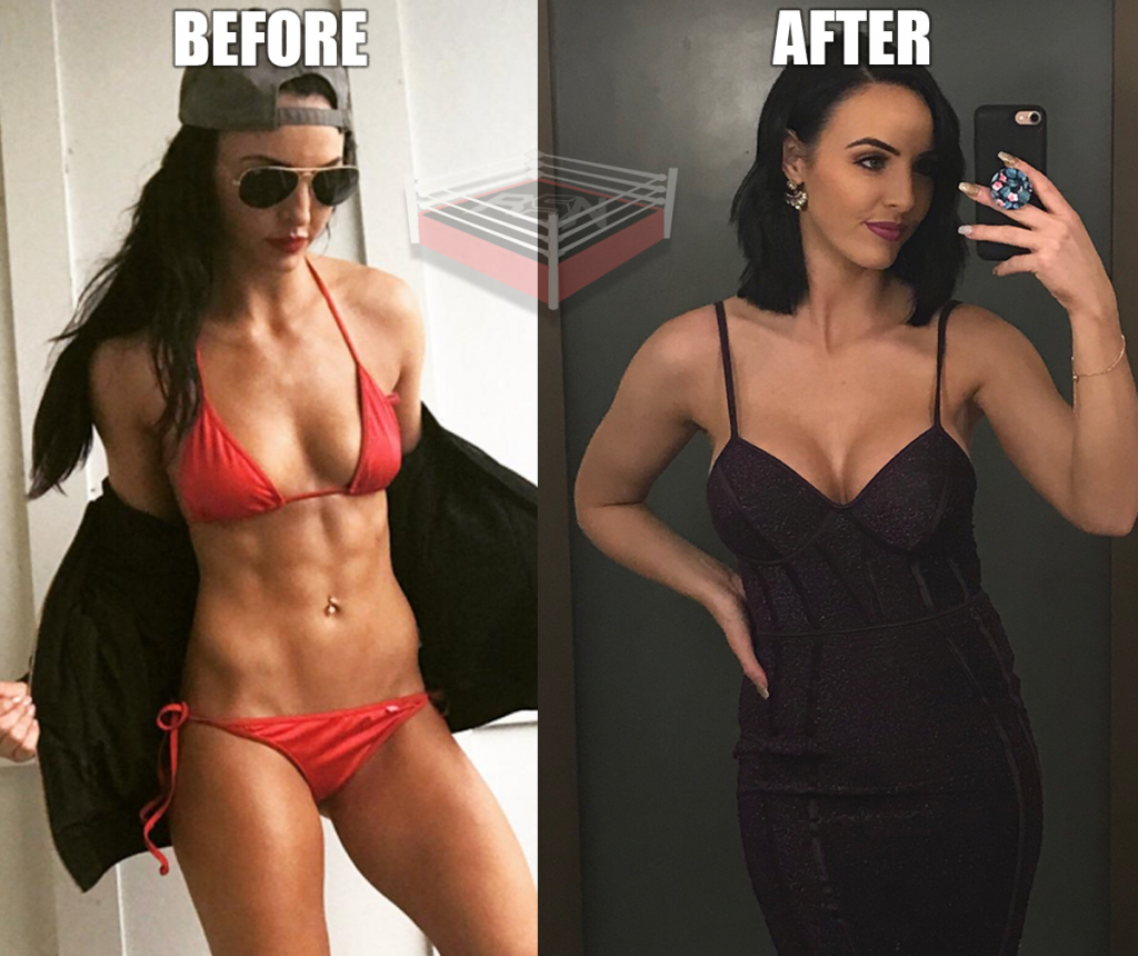 Peyton-Before-and-After-1024x860.png